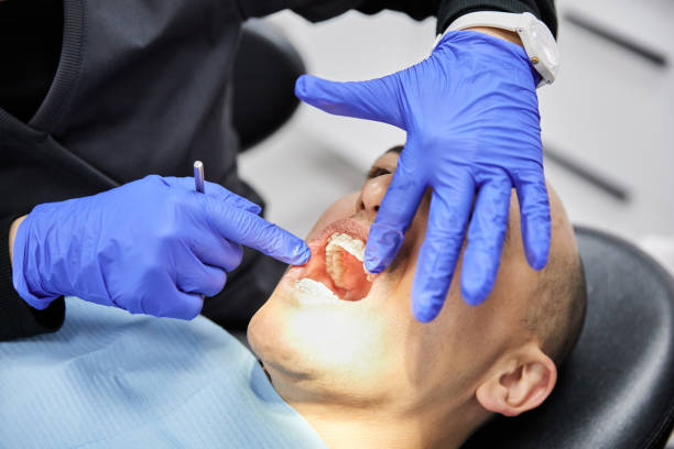Best Emergency Dental Extractions in Campbelltown, PA